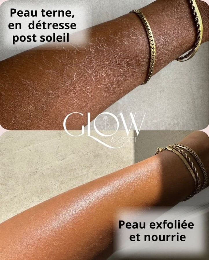 Exfoliation pour peau lumineuse