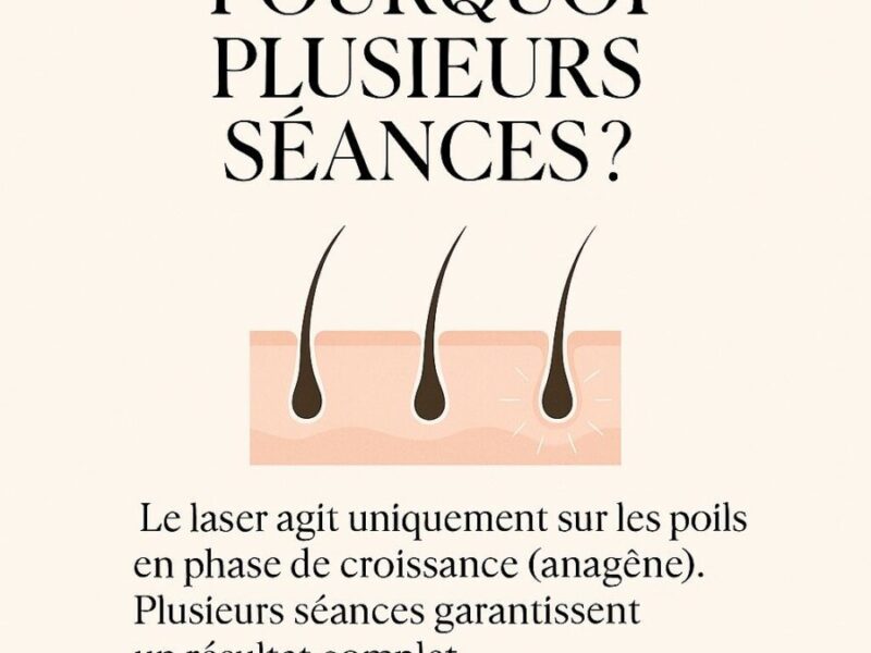 Tout savoir sur l’épilation laser et lumière pulsée en 2026