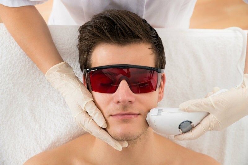 Épilation IPL pour débutants