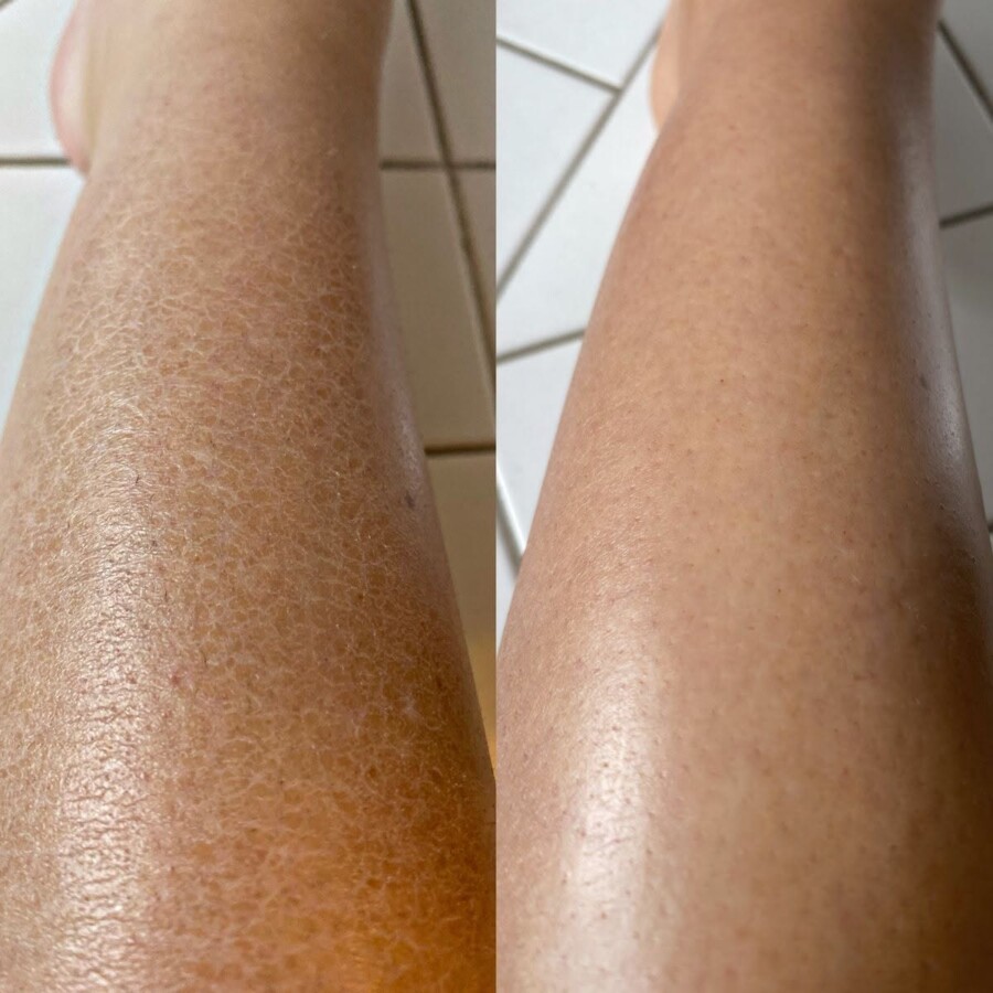 Comparaison gommage et exfoliation