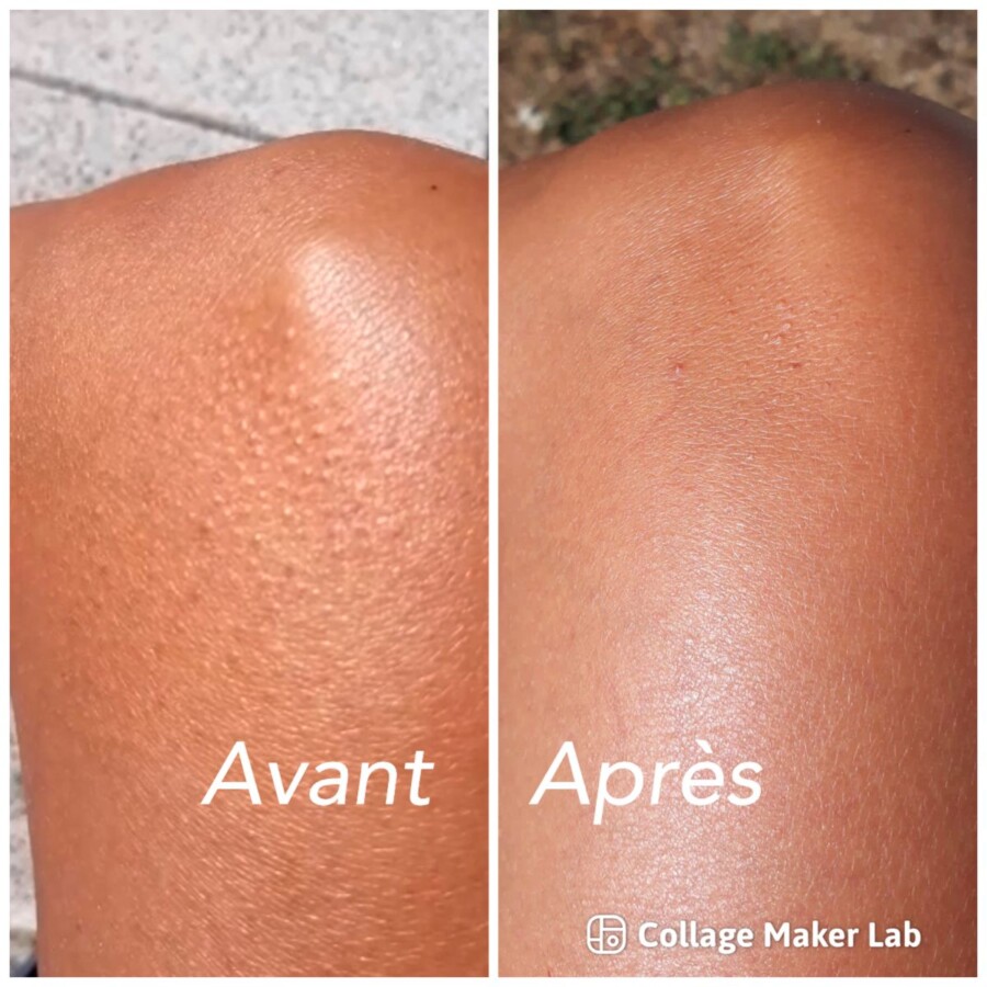 Comparaison gommage et exfoliation
