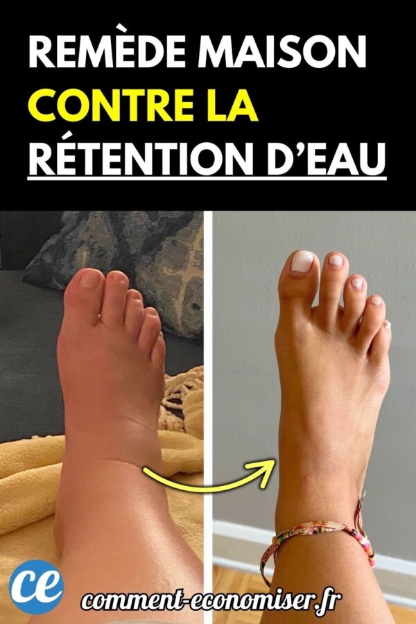Soins post-drainage efficaces