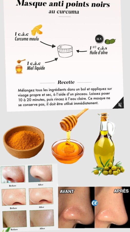 Recette anti-point noir maison