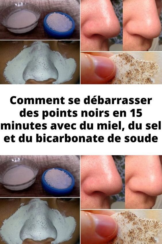 Masque DIY pour points noirs