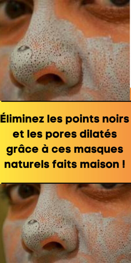 Masque DIY pour points noirs