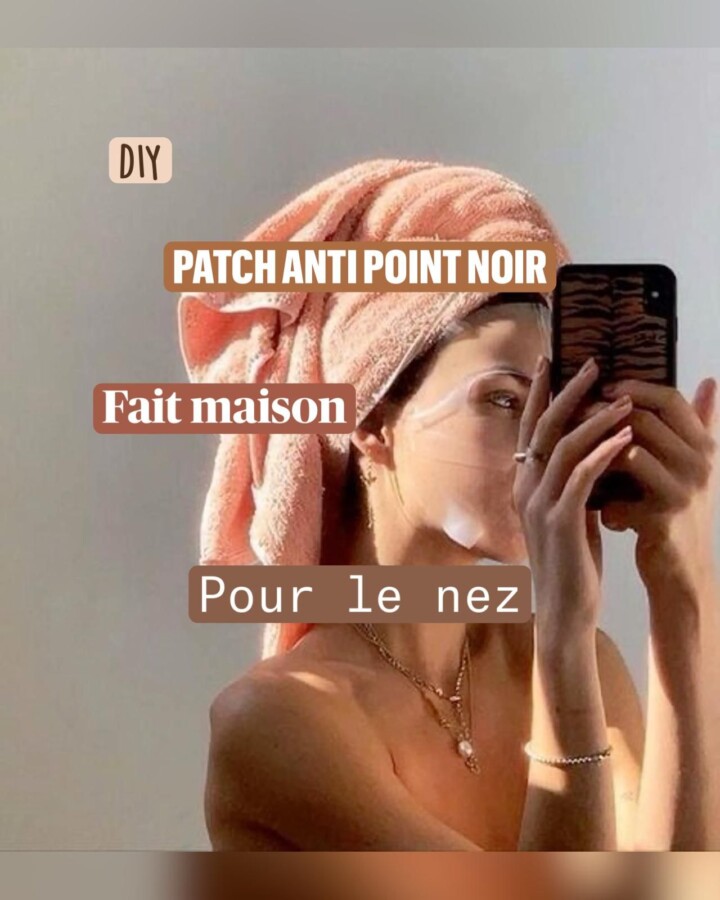 Solutions maison pour points noirs