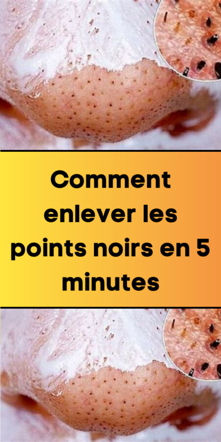 Recette anti-point noir maison